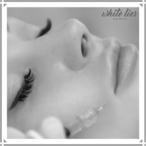 Filler at White lies